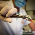خلع اسنان مجاني شامل الفحص وصور الاشعة