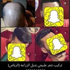لاتزرع شعر ولاتفكر بعد اليوم بالزراعه
