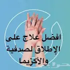 افضل علاج على إلا طلاق لصدفية والاكزيما