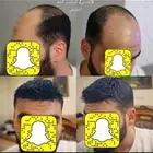 بوستيجة شعر طبيعي اصلي