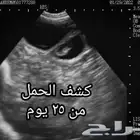 فحص الحلال بالسونار