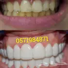 سناب أون سمايل المتحركة