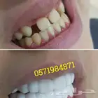 إبتسامة هوليود سمايل المتحركة