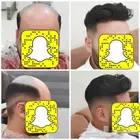 بوستيجه استراليه افضل نوع شعر لصق دائم