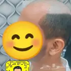 يونت تركيب شعر طبيعي للرجال