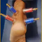 ابو عبدالله الخوارزمي للحجامة والمساج وفك الابهر