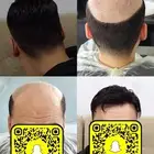 تركيب شعر طبيعي