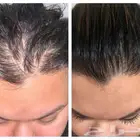 استعد م دمرته الكيماويات