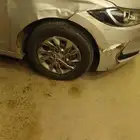 شفط وتعديل الصدمات بي6