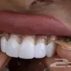 عرض أبتسامة هوليوود المتحركة الألمانية