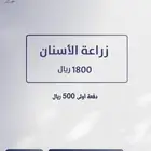 اقوى عروض زراعة الاسنان