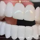 هوليود سمايل