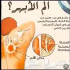 الابهر وعرق نساء و سفل الظهر والأعصاب والوف