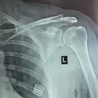أخصائي العلاج الطبيعي في المنزل Physiotherapy Specialist