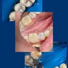 علاج اسنان مجاني في العابديه ام القرى مكه