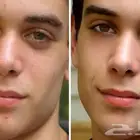 تعديل صور الهوية تصفية البشرة و اضافة مكياج اسعار رمزيه