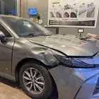 شفط وتعديل الصدمات بدون رش بويه