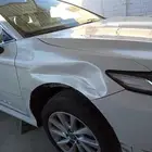 شفط وتعديل الصدمات بدون رش بويه