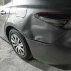 شفط وتعديل الصدمات بدون رش بويه