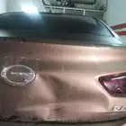 ورسة شفط وتعديل بدون بويه في أبها
