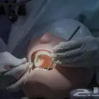 شرح مواد طب أسنان للمقبلين على الاختبارات