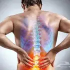 جلسات علاج الابهر والم اسفل الظهر وعرق النسا