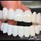 ابتسامة هوليود