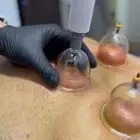 متخصص حجامة