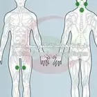 الحجامة النبوية بطريقة طبية علمية