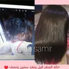 اقوي جلسات تريتمينت للأطفال والكبار نعومه لمعا