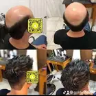 باروكة رجالي طبيعي لاصق دائم
