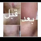 منتج للإكزيما و الصدفية