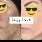 خلطات تبيض