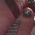 كرسيدا 87 مصدوم .