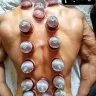 حجام مصري متخصص في عمل الحجامة