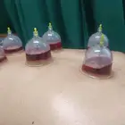 متخصص حجامة