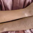 بدرة ازالة الشعر