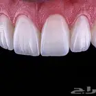 كتابة ملخصات   حل اختبارات   تصميم برزنتيشن  في طب الأسنان