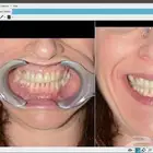 نقلة نوعية في عالم تصميم الأسنان الرقمية   Maestro 3D V6