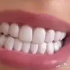 ابتسامة متحركة