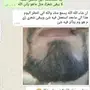 حصريا لدينا اقوى منتج للشعر ..w