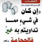 حجامة نبوية
