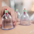 متخصص حجامة