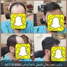 تركيب شعر طبيعي رجالي بديل الزراعه