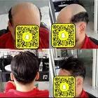 بوستيجة تركيب شعر طبيعي