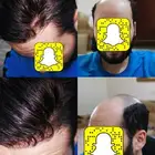 باروكة تركيب شعر طبيعي دائم