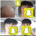 شعر بوستيجه امريكي دائم طبيعي