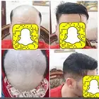 بوستيجة امريكي طبيعي بشري