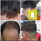 تركيب طبيعي رجالي