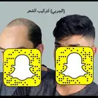باروكة للصلع اوروبي دائم